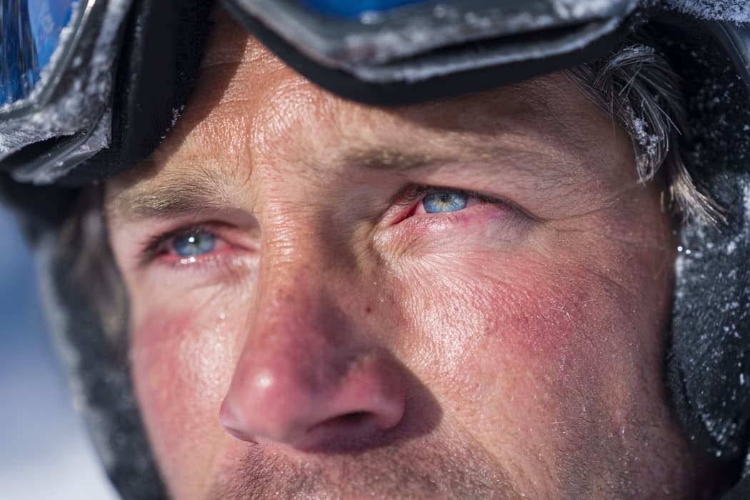 Plötzlich schmerzende Augen auf der Piste: Was hinter Schneeblindheit steckt – und wie Sie vorbeugen